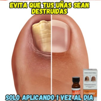 💥 Destruye Hongos y Repara tus Uñas: ¡Elimina los Hongos en Días y Recupera la Salud de tus Pies! 💅👣