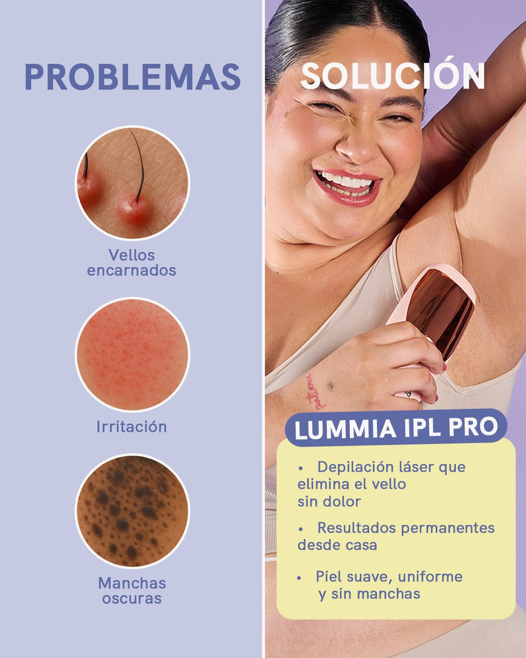 ✨ Depilación Láser en Casa: 🏠💫 Piel Suave, Siempre 💖🌸
