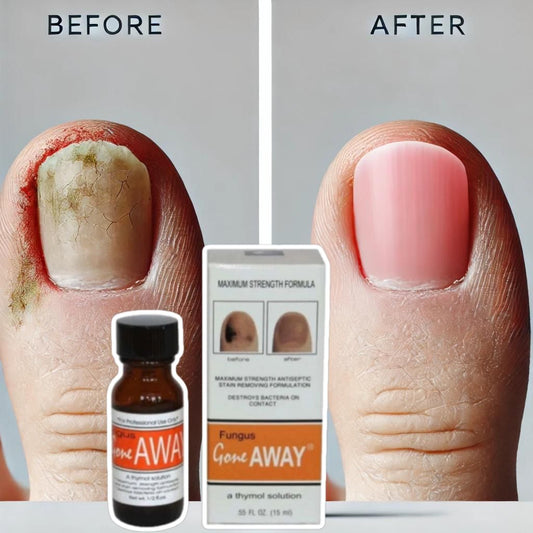 💥 Destruye Hongos y Repara tus Uñas: ¡Elimina los Hongos en Días y Recupera la Salud de tus Pies! 💅👣