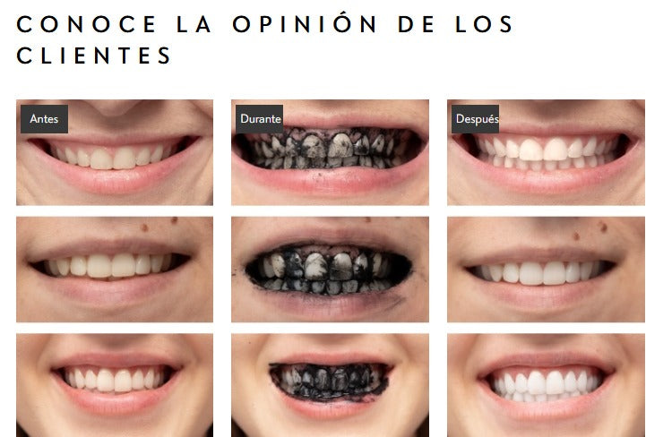 Combo Blanqueador Dental 2 en 1: Carbón Activado 🖤 + Luz LED 💡 para Dientes Extra Blancos+ Dos pasta Adicionales