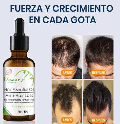 💆‍♂️ Aceite Anti-Caída + Spray Crecimiento GRATIS 🎁